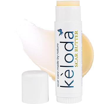Keloid Scar Care Butter Stick, Scars & Keloids Treatment Balm, For Surgical Scars & Keloids from Piercings, Stretch Marks, Acne, With Anti-Scar Cocoa, Shea Butter, Coconut, & Jojoba Oils